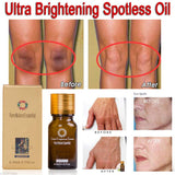 Ultra Brightening Skin Cream