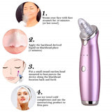 CC™ Electric Acne/Blackhead Remover